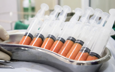 Τρεις λόγοι που κάνουν τη λιπομεταφορά ιδανική για εσάς